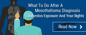 What to do after a mesothelioma diagnosis